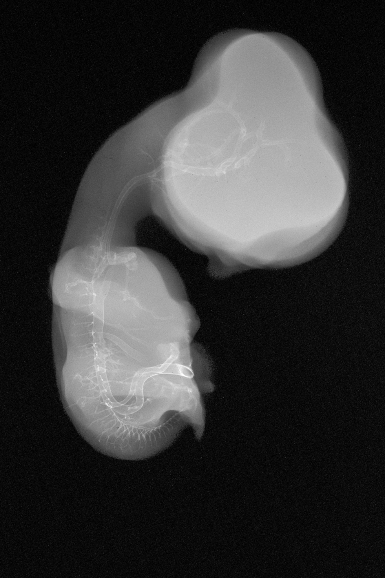 stage 30 chick embryo x-ray